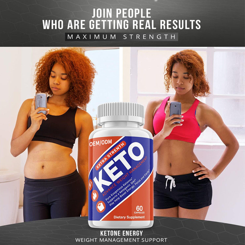 Van het de Capsulesgewicht van FDA Keto Slank Keto van het het Beheersverlies Vet Supplement voor Vrouwen en Mannen