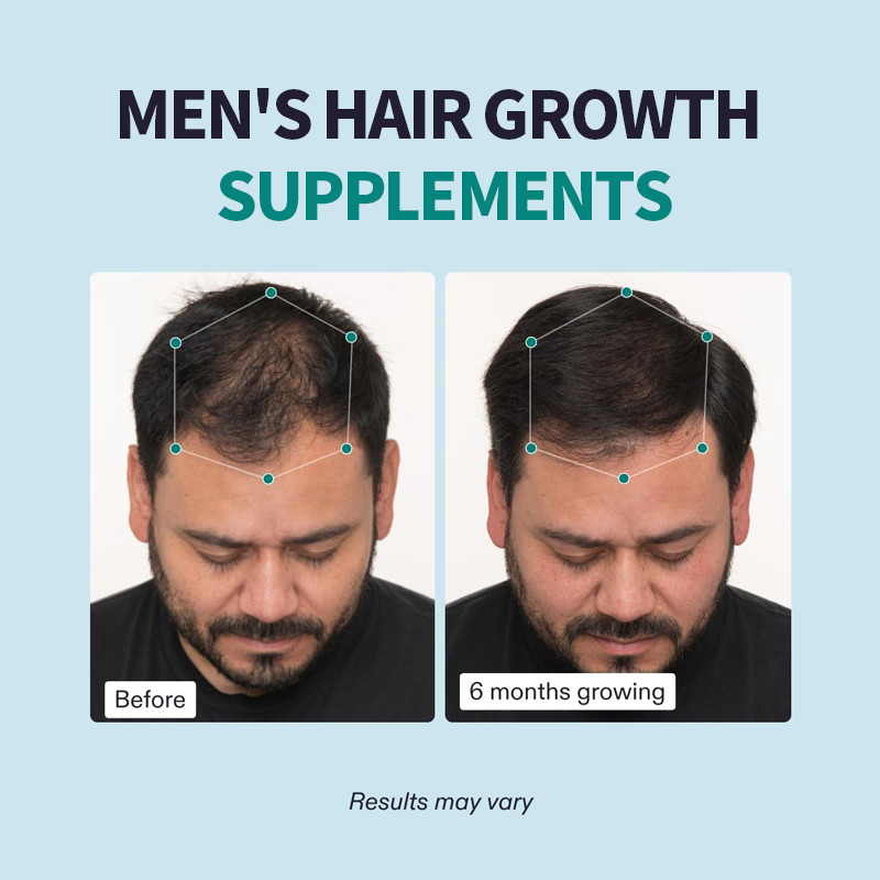 OEM Mensen haargroei supplementen Zichtbaar dikker haar en hoofdhuid dekking mannen haar capsules