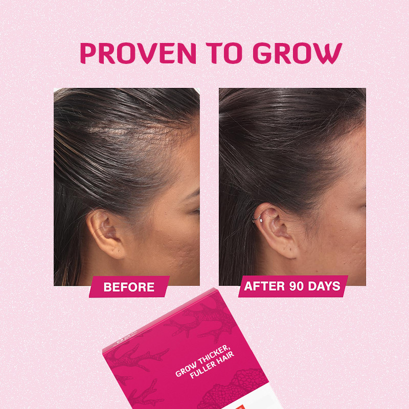 Haargroei Tabletten 120mcg Biotine Haargroei Product Voor Haargroei